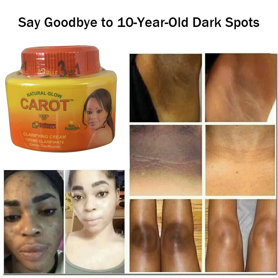 Carot Extract Body & Face Cream – 300ml – Daily Moisture with Vitamin