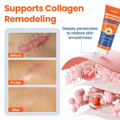 DermalRebuild Skin Renewal Gel