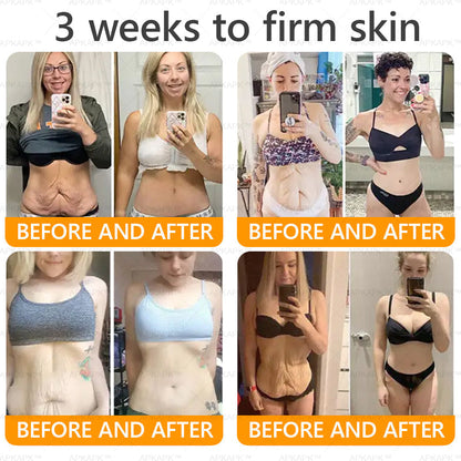 Made and Shipped from USA ✨ LUMIVO™ Bee venom Comprehensive Cream 🔥 LAST DAY 80% OFF 💎💎
