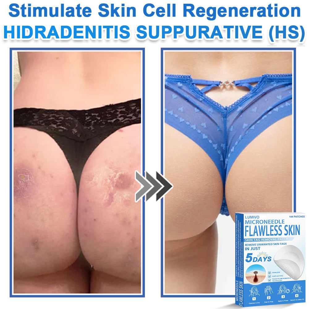 🎁 SkinPrikyn™ 2-in-1 Microneedle & Hydrocolloid PatchLUMIVO