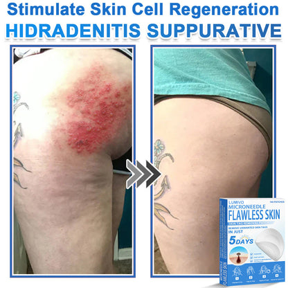 🎁 SkinPrikyn™ 2-in-1 Microneedle & Hydrocolloid PatchLUMIVO